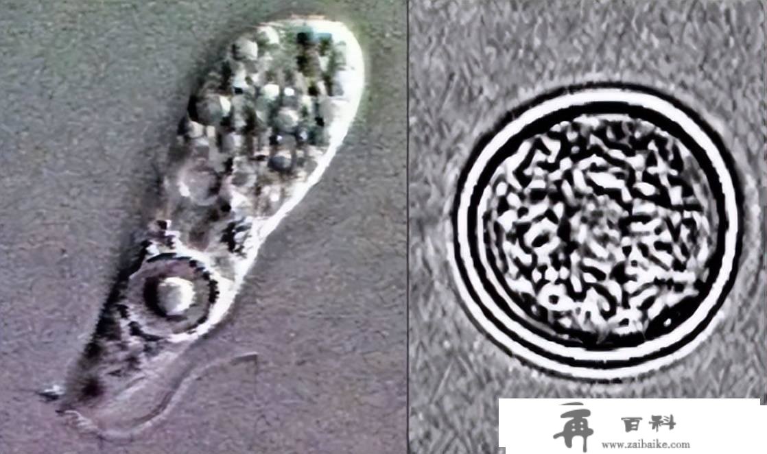 美国自来水管发现阿米巴原虫！致死率高达97%！不枉“食脑虫”恶名