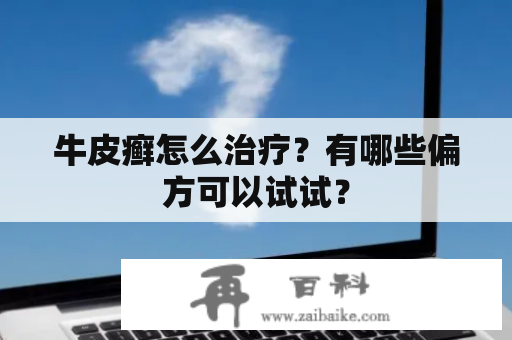 牛皮癣怎么治疗？有哪些偏方可以试试？