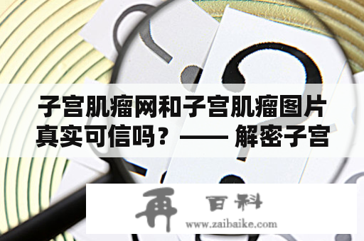 子宫肌瘤网和子宫肌瘤图片真实可信吗？—— 解密子宫肌瘤网上的图片真相