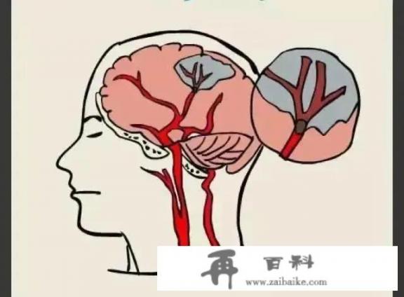 每天吃片银杏叶片对身体有益吗？为什么？