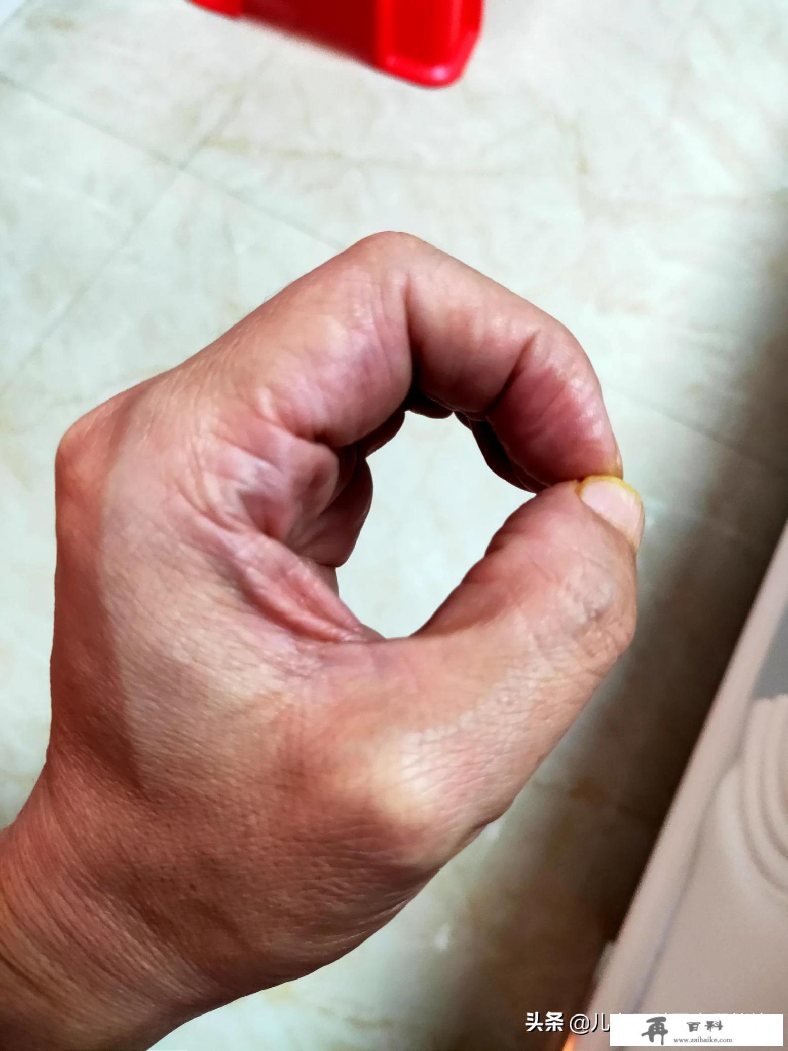 腰椎盘突出怎么治？