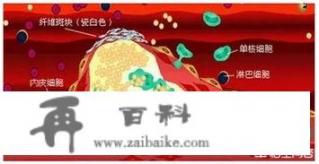 脑血栓痊愈后是怎样的？要注意什么？