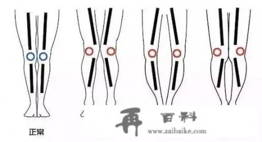 怎样能增高身高？
