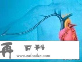 PICC管是什么？